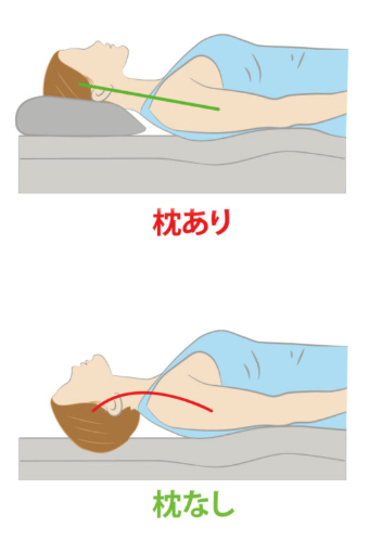 ストレートネックにオススメの枕とは どんな枕がいいのか徹底解説 寝具百科