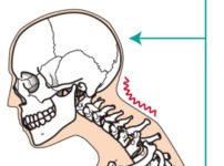 首の筋肉に負担がかからない枕
